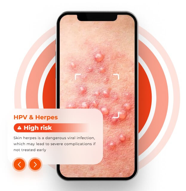 Skinive HPV and herpes high risk detection example