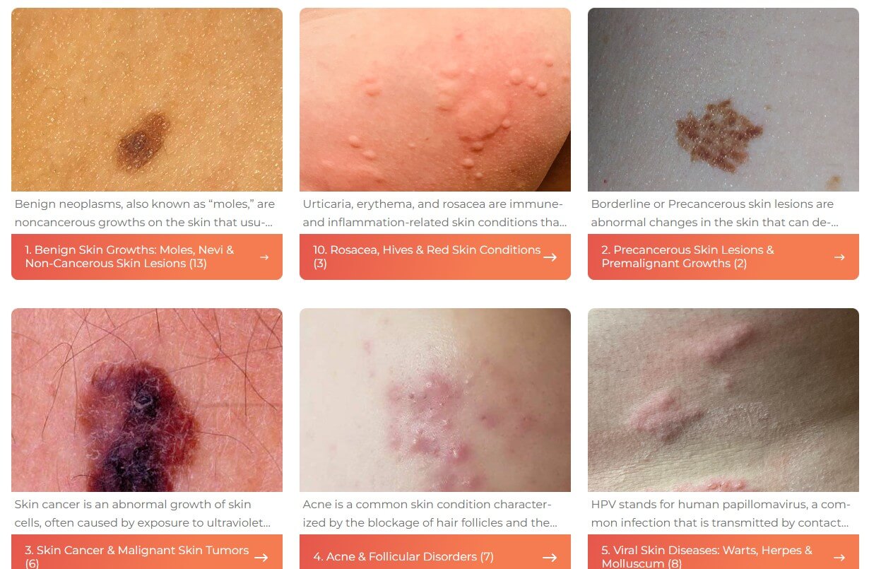 Skinive skin directory and treatment guide category grid